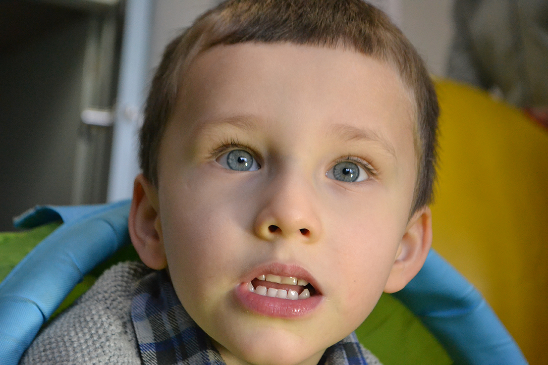 Generalized Anxiety Disorder In Children